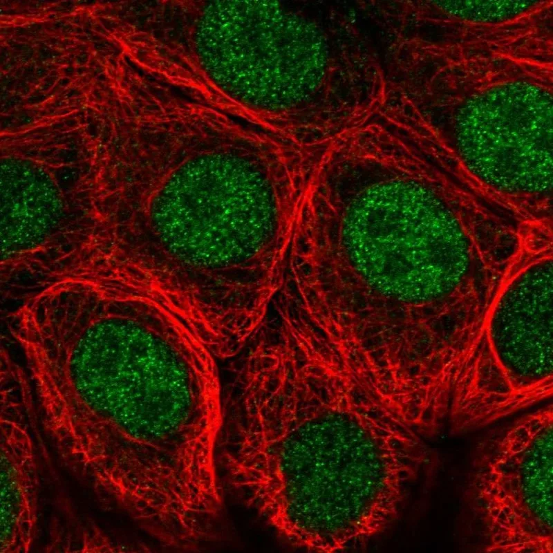 Atlas Antibodies Anti-MNX1 Antibody