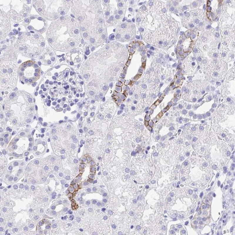 Atlas Antibodies Anti-MON1A Antibody