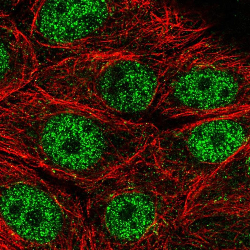 Atlas Antibodies Anti-MORN2 Antibody