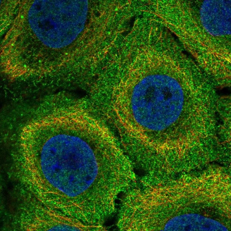 Atlas Antibodies Anti-MR1 Antibody