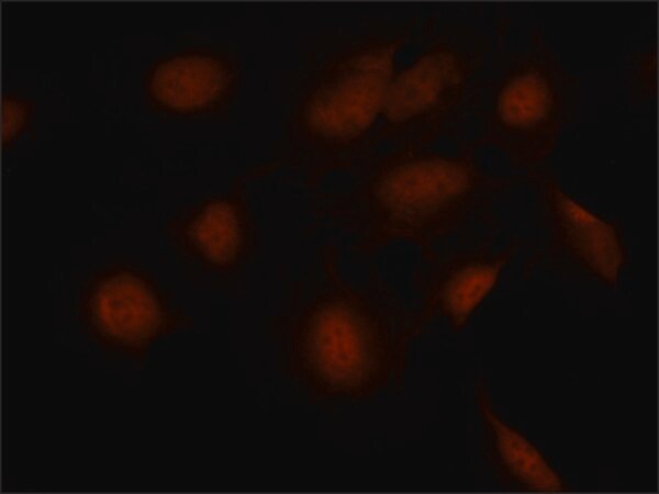 Merck Anti-SMAD7 (N-terminal) antibody produced in rabbit