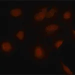 Merck Anti-SMAD7 (N-terminal) antibody produced in rabbit
