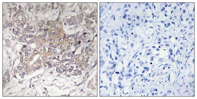 Merck Anti-GCNT3 antibody produced in rabbit