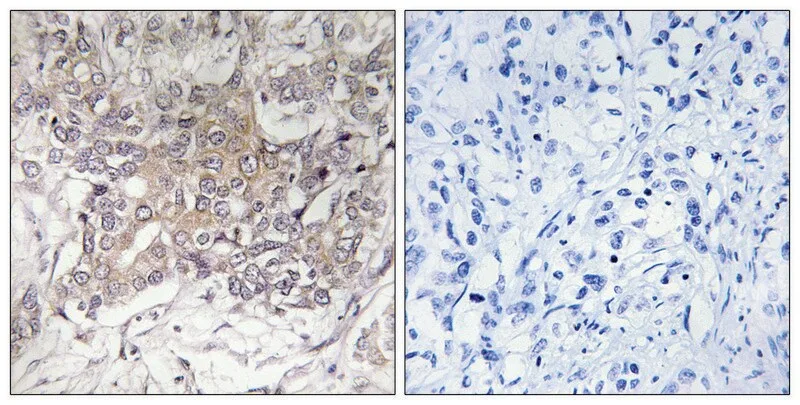 Merck Anti-GCNT3 antibody produced in rabbit