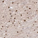 Merck Anti-TBX5 antibody produced in rabbit