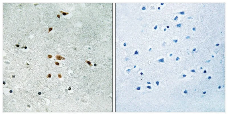 Merck Anti-phospho-FER (pTyr402) antibody produced in rabbit