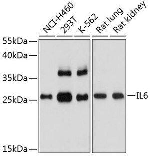 Merck ANTI-IL6 ANTIBODY PRODUCED IN RABBIT