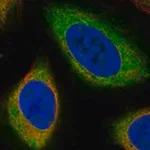 Merck Anti-PDE9A antibody produced in rabbit