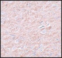 Merck ANTI-PRDM16