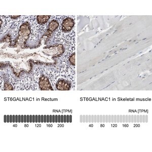 Merck ANTI-ST6GALNAC1
