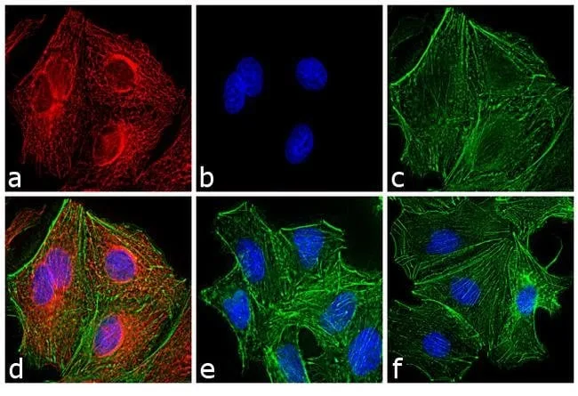 Thermo Fisher Scientific Donkey anti-Rat IgG (H+L) Highly Cross-Adsorbed Secondary Antibody, Alexa Fluor 594