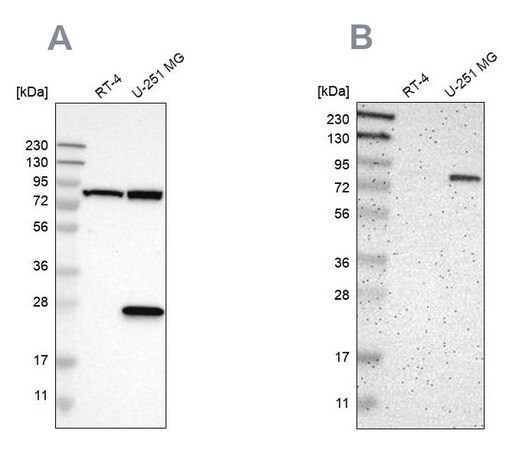 Merck Anti-ALDH18A1 antibody produced in rabbit