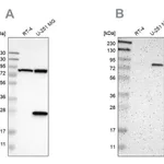 Merck Anti-ALDH18A1 antibody produced in rabbit