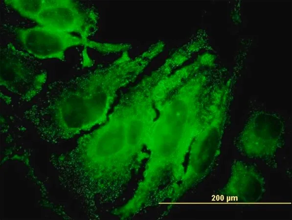 Merck ANTI-RPS6KB1 antibody produced in mouse