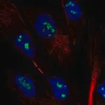 Merck Anti-MAGEH1 antibody produced in rabbit