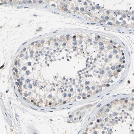 Merck Anti-LHX9 antibody produced in rabbit