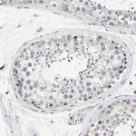 Merck Anti-LHX9 antibody produced in rabbit