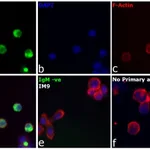Thermo Fisher Scientific Goat anti-Human IgM (Heavy chain) Cross-Adsorbed Secondary Antibody, Alexa Fluor 488