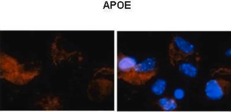 Merck Anti-APOE (N-terminal) antibody produced in rabbit