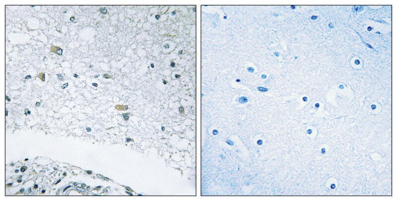 Merck Anti-LAMC3 antibody produced in rabbit
