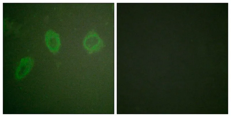Merck Anti-HER2 antibody produced in rabbit