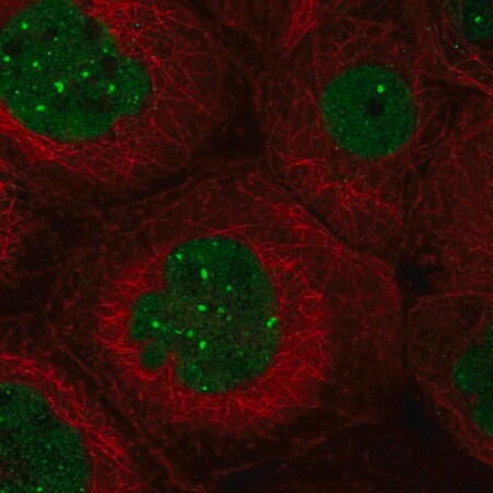 Merck Anti-TMEM94 antibody produced in rabbit
