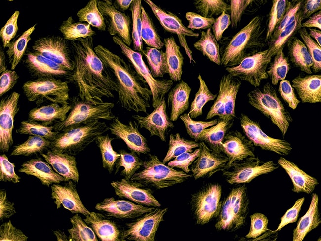 Thermo Fisher Scientific Donkey anti-Rat IgG (H+L) Highly Cross-Adsorbed Secondary Antibody, Alexa Fluor Plus 555