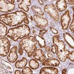 Merck Anti-MTHFD2 antibody produced in rabbit