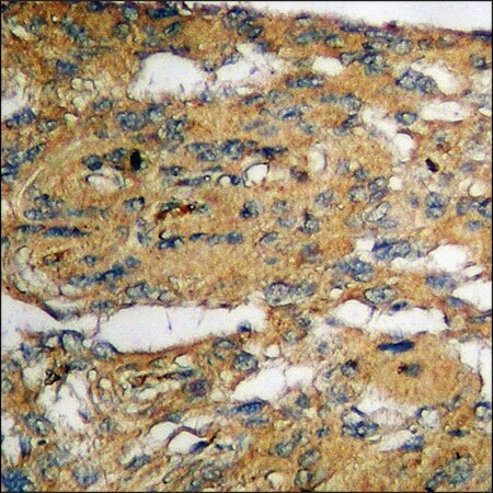 Merck Anti-phospho-IKK-alpha/beta (pSer180/181) antibody produced in rabbit