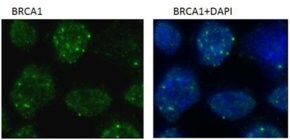 Merck MONOCLONAL ANTI-BRCA1