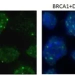 Merck MONOCLONAL ANTI-BRCA1