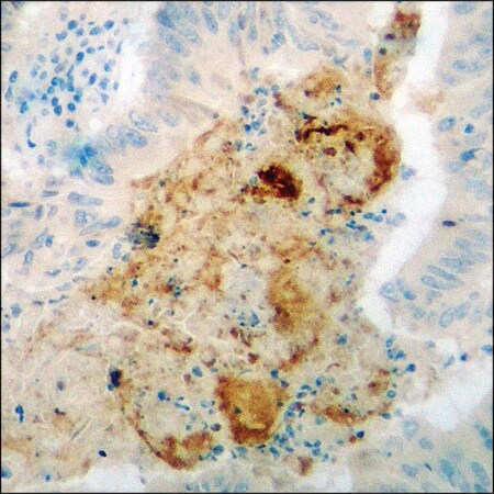 Merck Anti-phospho-PP2A-alpha (pTyr307) antibody produced in rabbit
