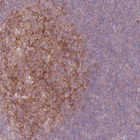 Merck Anti-RFTN1 antibody produced in rabbit