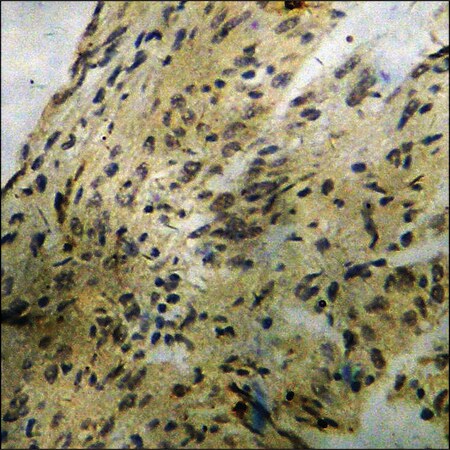 Merck Anti-phospho-BCL-2 (pSer70) antibody produced in rabbit