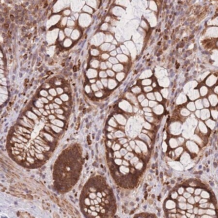 Merck Anti-MRPL23 antibody produced in rabbit