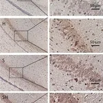 Merck ANTI-NEUROGLOBIN