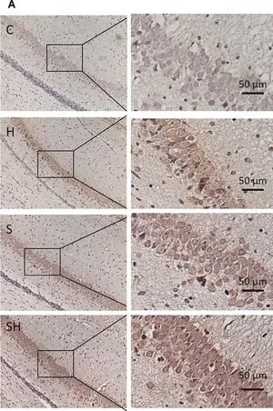 Merck ANTI-NEUROGLOBIN