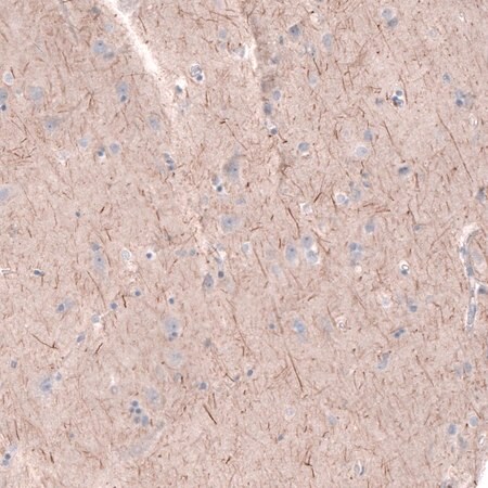 Merck Anti-PTPRK antibody produced in rabbit
