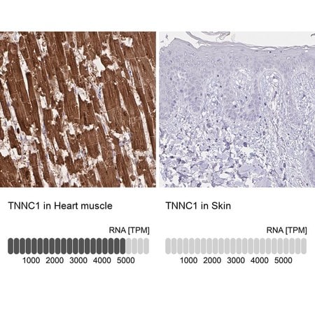 Merck Anti-TNNC1 antibody produced in rabbit