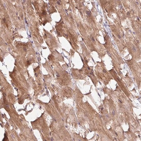 Merck Anti-TIMMDC1 antibody produced in rabbit