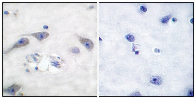 Merck Anti-DARPP-32 antibody produced in rabbit