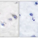 Merck Anti-DARPP-32 antibody produced in rabbit