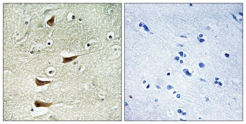 Merck Anti-MAP3K10 antibody produced in rabbit