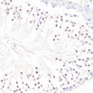 Merck ANTI-GLI1 ANTIBODY PRODUCED IN RABBIT
