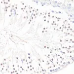 Merck ANTI-GLI1 ANTIBODY PRODUCED IN RABBIT