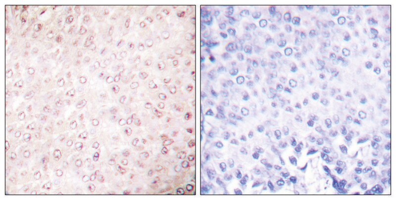 Merck Anti-p300 antibody produced in rabbit