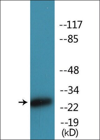 Merck Anti-phospho-CD28 (pTyr218) antibody produced in rabbit