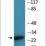 Merck Anti-phospho-CD28 (pTyr218) antibody produced in rabbit