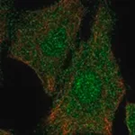Merck Anti-ELP5 antibody produced in rabbit