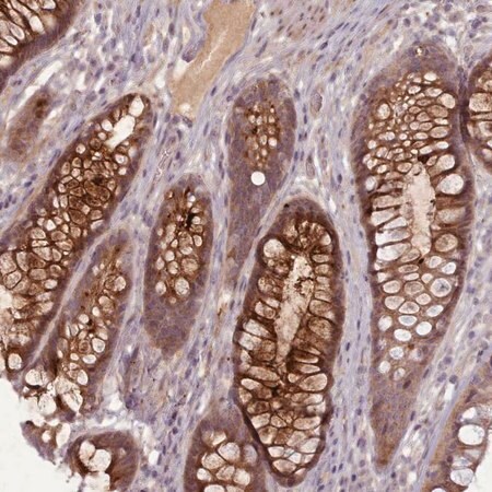 Merck Anti-LEFTY1 antibody produced in rabbit